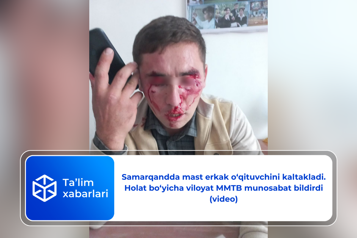 Samarqandda mast erkak o‘qituvchini kaltakladi. Holat bo‘yicha viloyat MMTB munosabat bildirdi (video)