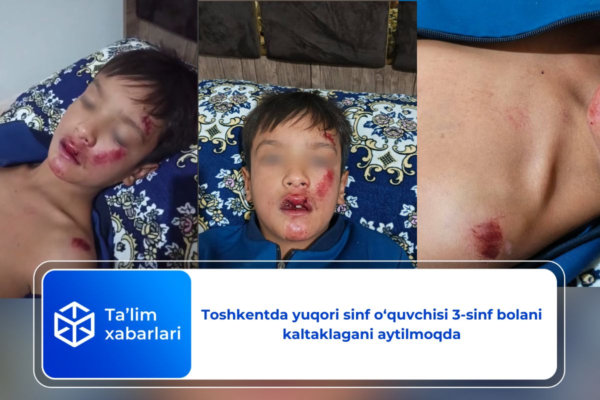 Toshkentda yuqori sinf o‘quvchisi 3-sinf bolani kaltaklagani aytilmoqda