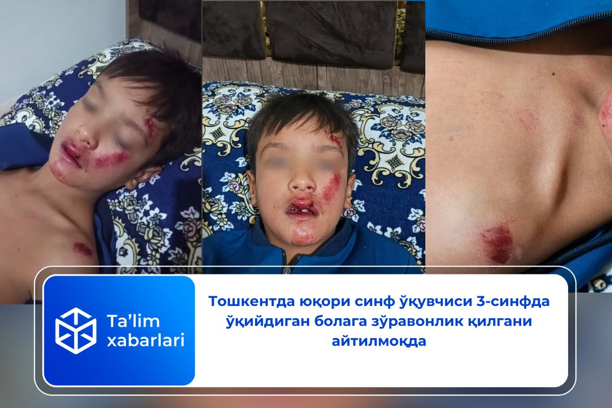 Тошкентда юқори синф ўқувчиси 3-синфда ўқийдиган болага зўравонлик қилгани айтилмоқда