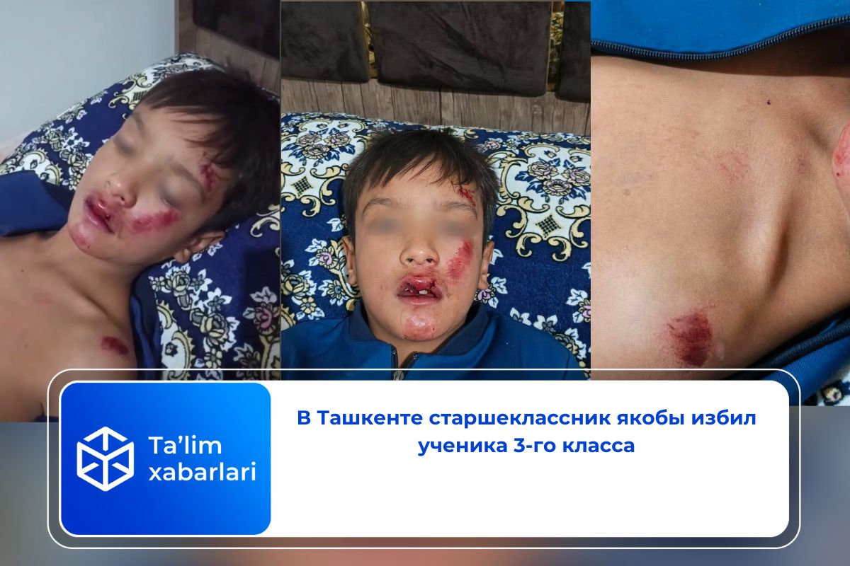 В Ташкенте старшеклассник якобы избил ученика 3-го класса