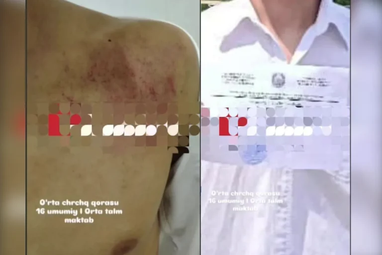 Oʻrta Chirchiqdagi maktabda direktor oʻquvchini kaltaklagani aytilmoqda