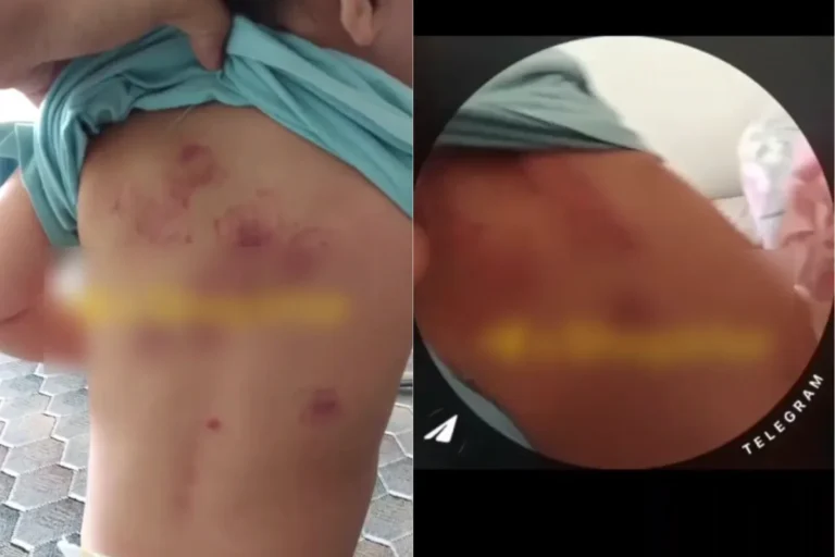 Samarqanddagi bogʻchada 1 yosh-u 9 oylik bola kaltaklangan